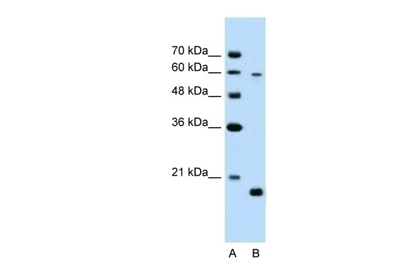 SLC38A4 Antibody