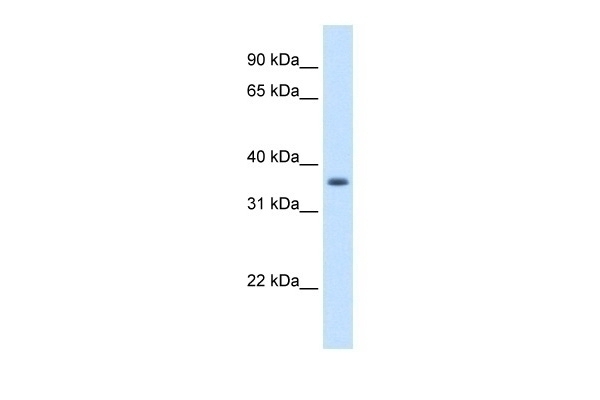 AKR1B10 Antibody