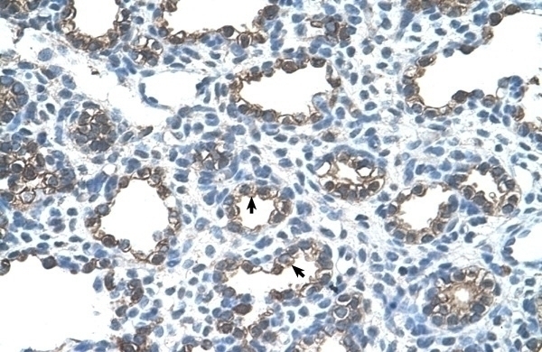 ANK1 Antibody