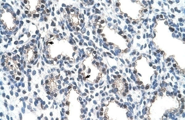 THOC4 Antibody
