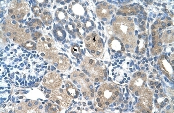 FBXO25 Antibody