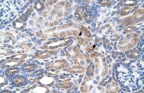 SLC29A2 Antibody