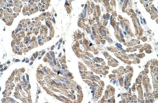 SLC25A38 Antibody