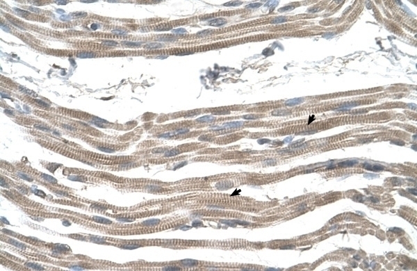 SLC25A22 Antibody