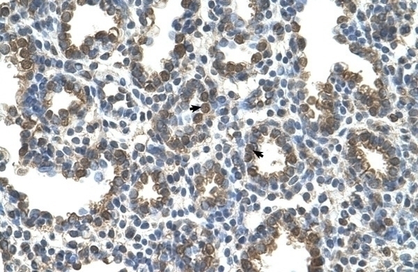 SLC37A3 Antibody