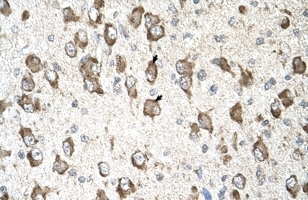 SLC26A8 Antibody
