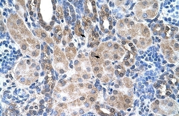 SLC6A18 Antibody