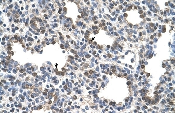 BCHE Antibody