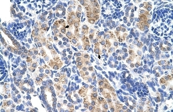 ALDH3A2 Antibody