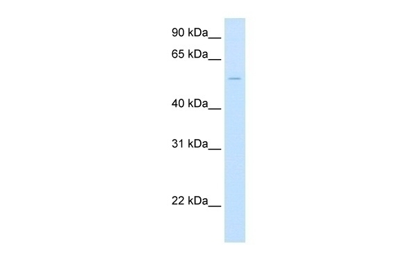 UGT1A1 Antibody