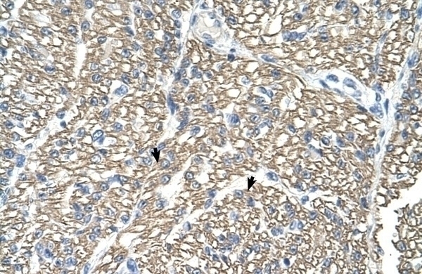 ATP1B1 Antibody