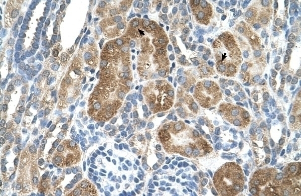 C6orf21 Antibody
