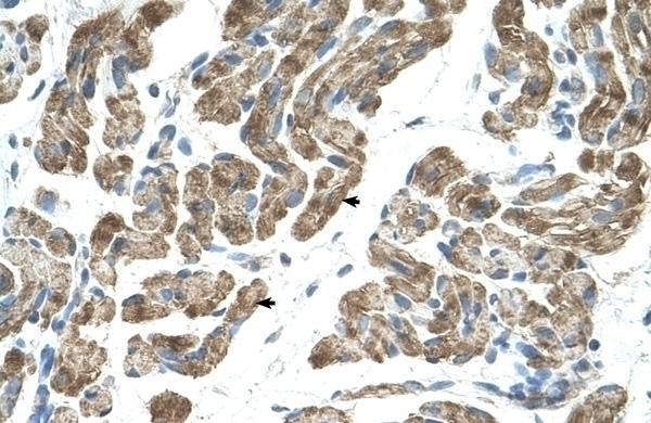 ACVR1 Antibody