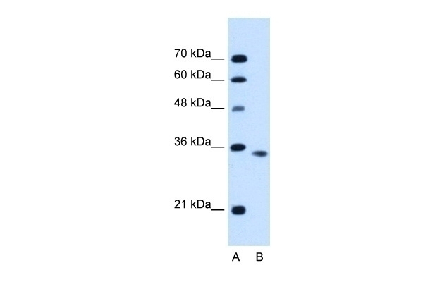 ACVR2B Antibody