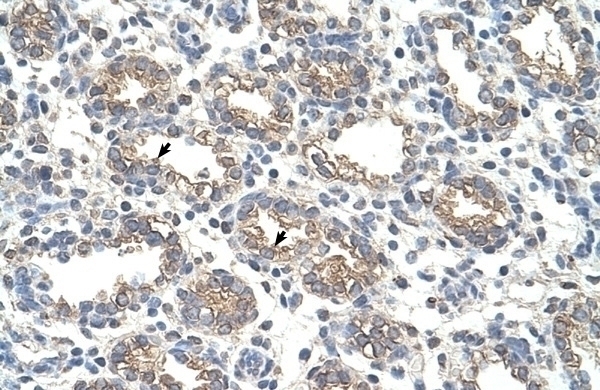 ARG1 Antibody