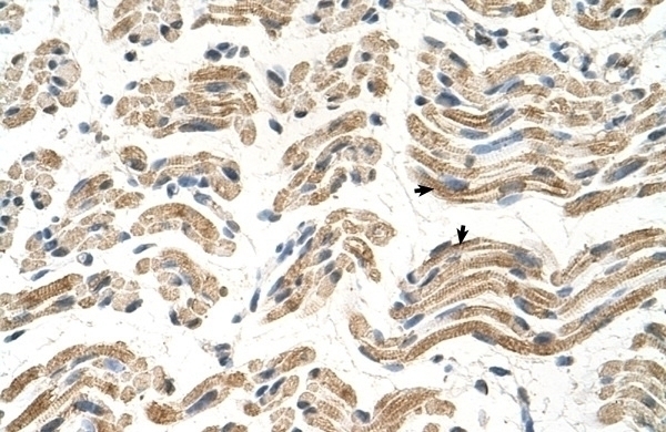 ALDH4A1 Antibody