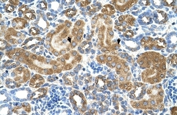 ATIC Antibody