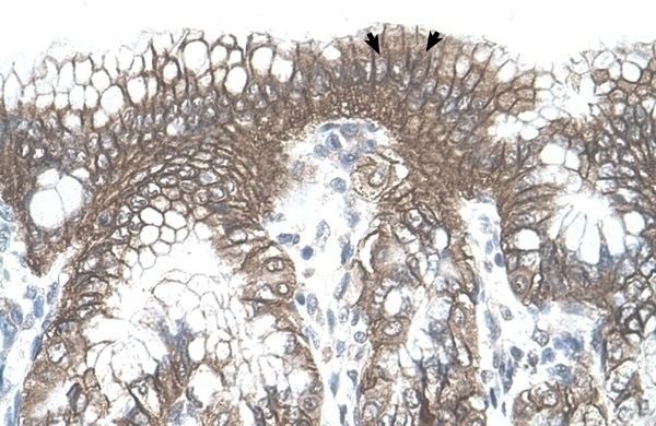 TARS Antibody