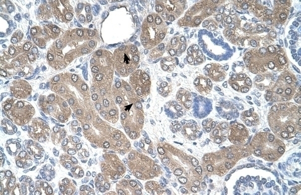 ST3GAL5 Antibody
