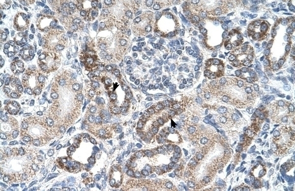 UST Antibody