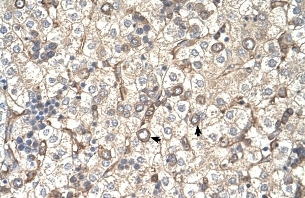 ST3GAL4 Antibody
