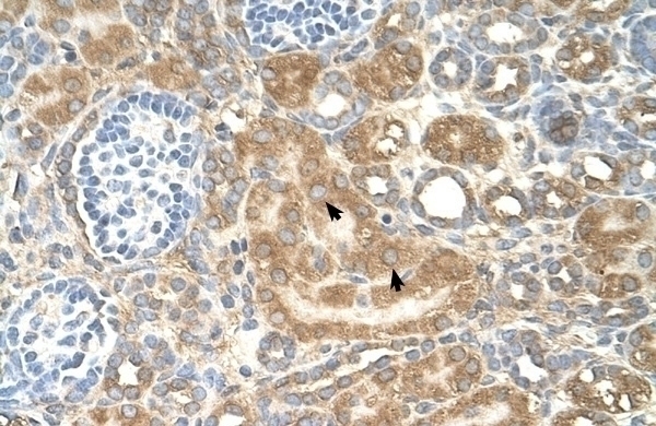 SPTLC1 Antibody