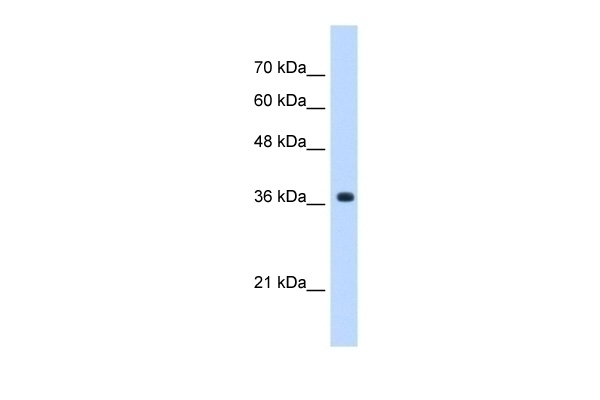 A4GNT Antibody