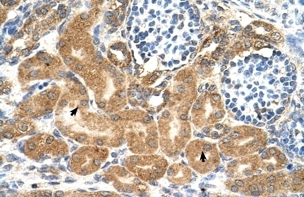 TMEM69 Antibody