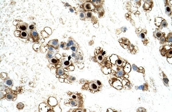 UNCX Antibody