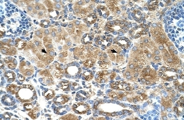 UBXD2 Antibody