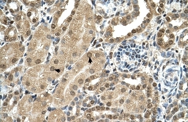 TBX15 Antibody