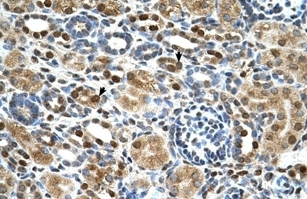 ZNF169 Antibody