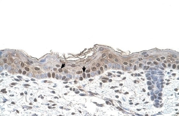 ARRB2 Antibody
