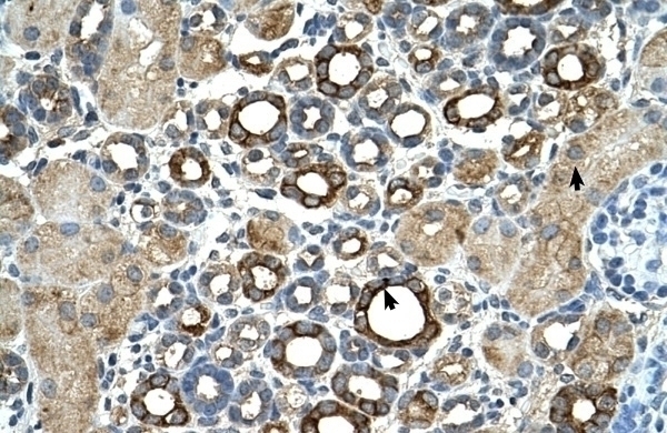 ST14 Antibody