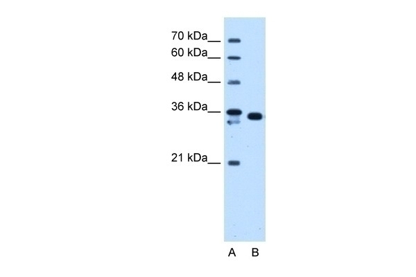 AKR1B1 Antibody