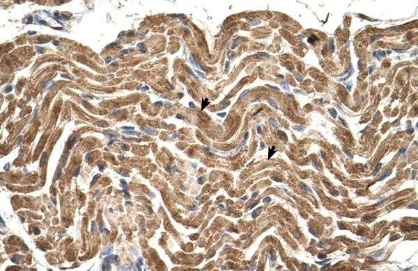ATP5B Antibody