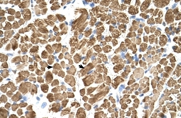 TPM2 Antibody
