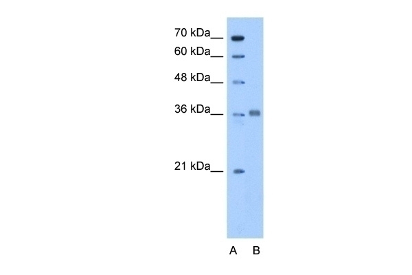 ALDOC Antibody