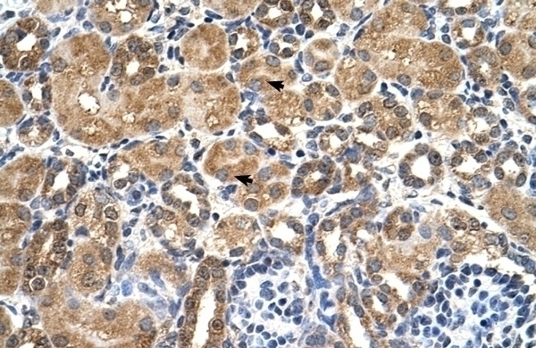 STK3 Antibody