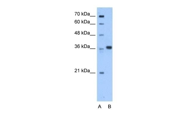 AASDHPPT Antibody