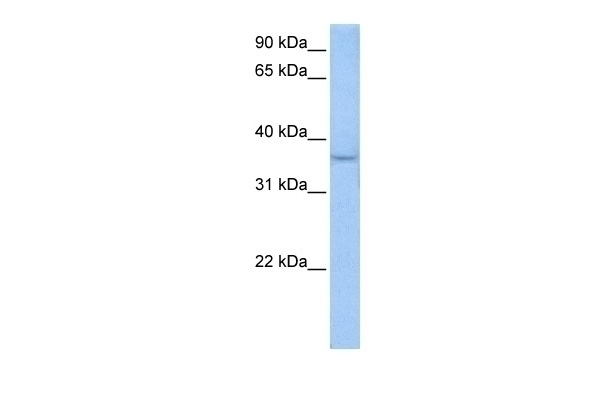 ACPT Antibody