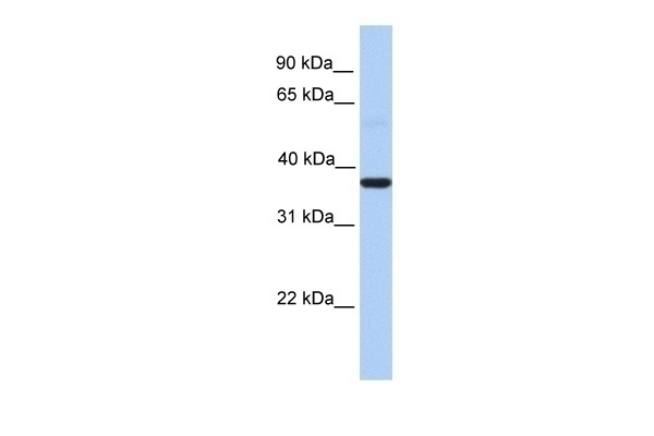 ZC3H15 Antibody
