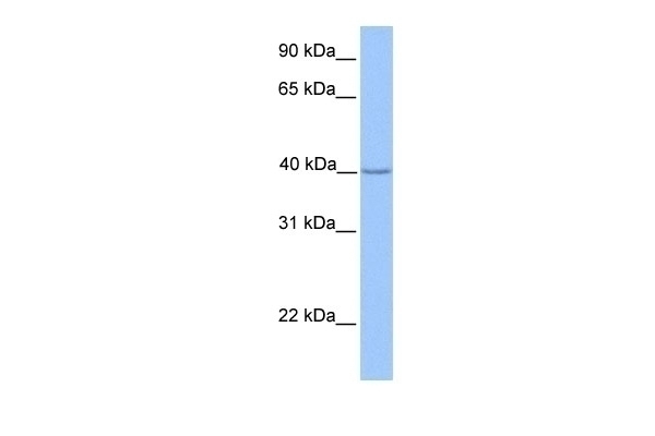 ZNF385D Antibody