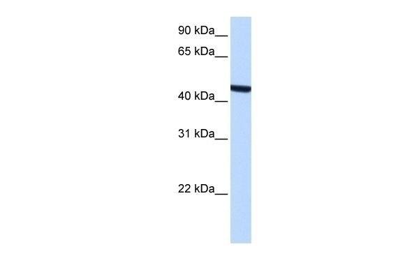 ZCCHC3 Antibody