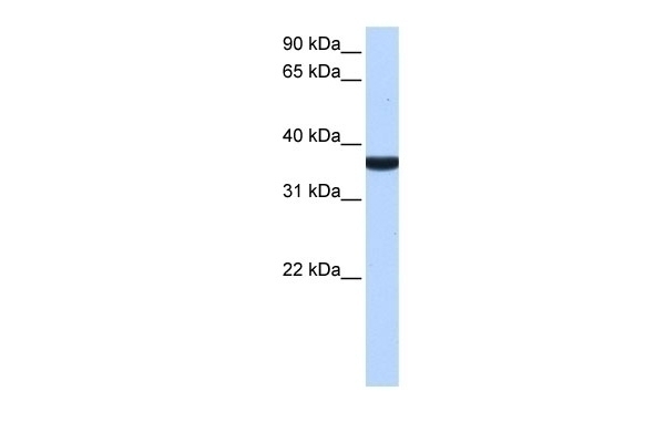 TP53I13 Antibody