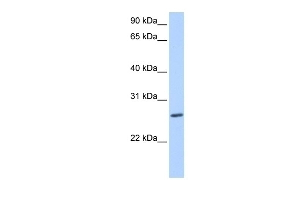ZNF664 Antibody