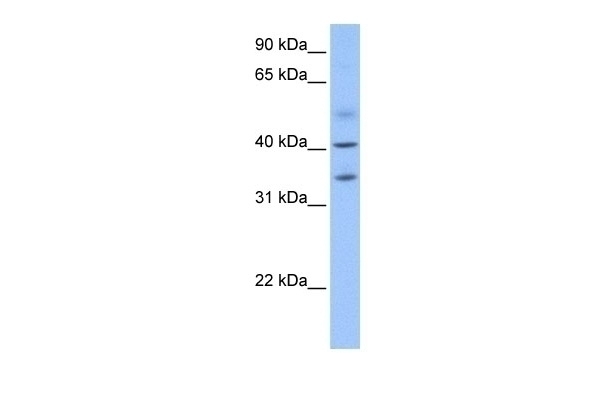 ZC3H14 Antibody