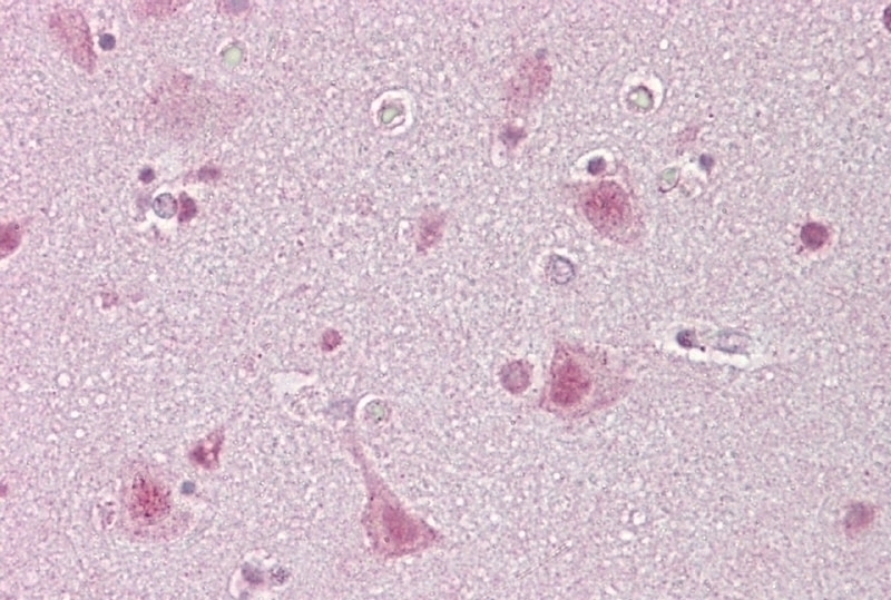 SREBF1 Antibody