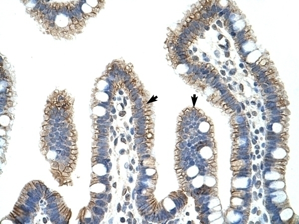 CTNNB1 Antibody