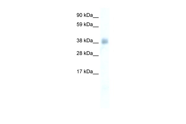 YY1 Antibody